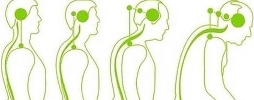 Uterine thunder loses mobility